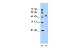 SLC30A1 Polyclonal Antibody
