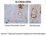 SLC39A8 Polyclonal Antibody
