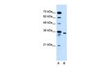 SLC25A32 Polyclonal Antibody