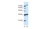 SLC9A7 Polyclonal Antibody