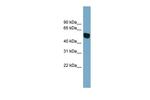 SLC38A5 Polyclonal Antibody