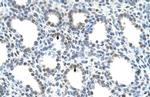 SLC15A4 Antibody in Immunohistochemistry (IHC)