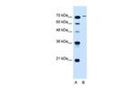 SLCO6A1 Polyclonal Antibody