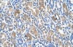 SLC36A3 Polyclonal Antibody