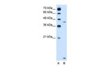 SLC46A3 Antibody in Western Blot (WB)