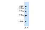 SLC16A12 Polyclonal Antibody