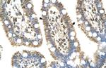 C8B Antibody in Immunohistochemistry (IHC)