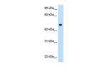 C8B Antibody in Western Blot (WB)