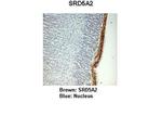 SRD5A2 Polyclonal Antibody