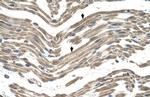 C1QB Polyclonal Antibody