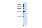 ZDHHC13 Antibody in Western Blot (WB)