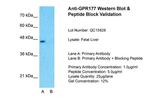 GPR177 Antibody in Western Blot (WB)