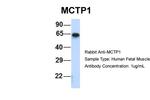 MCTP1 Antibody in Western Blot (WB)
