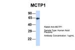 MCTP1 Polyclonal Antibody