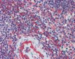 MCTP1 Antibody in Immunohistochemistry (Paraffin) (IHC (P))