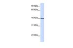 GP2 Antibody in Western Blot (WB)