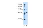 ARMCX6 Antibody in Western Blot (WB)