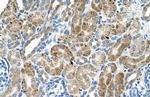 VMA21 Polyclonal Antibody