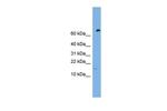 IFITM5 Polyclonal Antibody