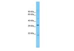 CCDC90A Polyclonal Antibody