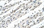 RCE1 Antibody in Immunohistochemistry (IHC)