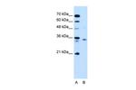 RCE1 Antibody in Western Blot (WB)