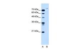 USP48 Polyclonal Antibody