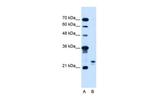 MOSPD3 Antibody in Western Blot (WB)