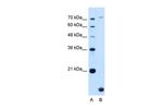 TMEM91 Polyclonal Antibody