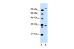 TMEM231 Antibody in Western Blot (WB)