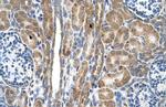 FAM55D Polyclonal Antibody