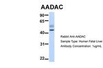 AADAC Polyclonal Antibody