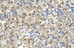 TETRAN Antibody in Immunohistochemistry (IHC)