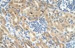 IHH Polyclonal Antibody