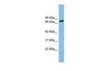 Lamin B Receptor Polyclonal Antibody