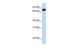 LRCH4 Polyclonal Antibody