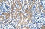 RAP Polyclonal Antibody