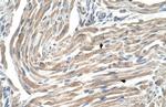 MGST2 Polyclonal Antibody