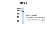 MTX1 Antibody in Western Blot (WB)