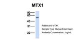 MTX1 Antibody in Western Blot (WB)