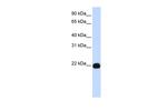PIGA Polyclonal Antibody