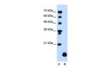 PLP2 Polyclonal Antibody