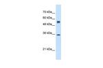 TRAP alpha Antibody in Western Blot (WB)