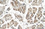 SSR2 Antibody in Immunohistochemistry (IHC)