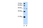 Tapasin Antibody in Western Blot (WB)