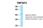 TM7SF2 Antibody in Western Blot (WB)