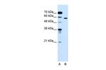 ORP9 Antibody in Western Blot (WB)
