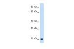 Plasma Kallikrein Antibody in Western Blot (WB)