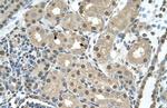 SBDS Antibody in Immunohistochemistry (IHC)