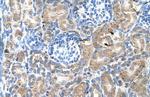 SGPP2 Polyclonal Antibody